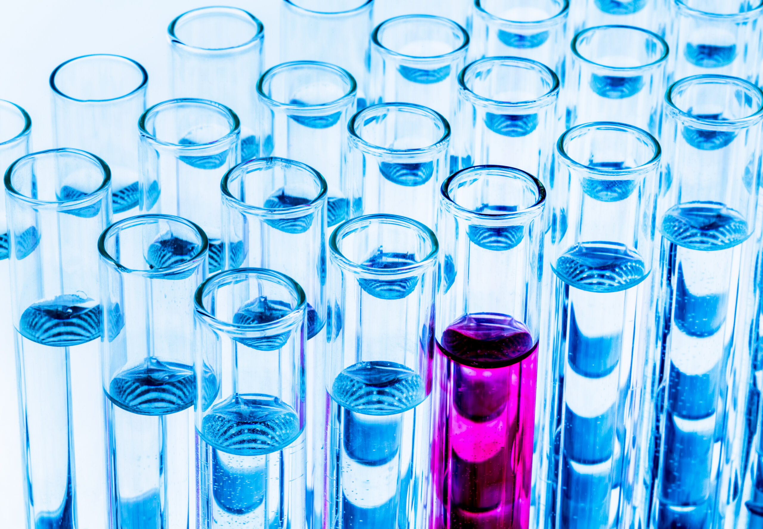 Пробирки лабораторные с кровью. Реакционные пробирки. Много пробирок. Лаборатория пробирки. Пробирки с кровью в штативе.